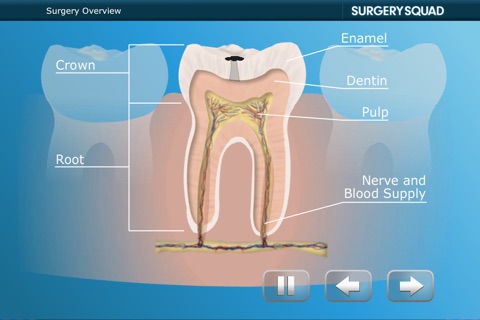 Surgery Squad's Virtual Root Canal Procedure screenshot 4