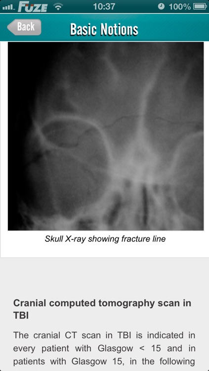 Traumatic Brain Injury (TBI)