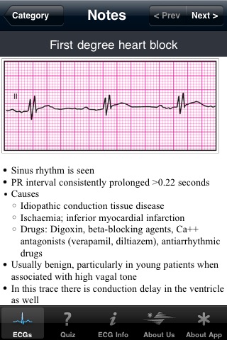 ECG Pocket Reference UK screenshot 2