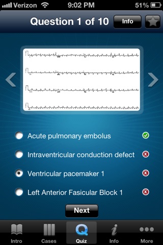 ECG - An Electrocardiogram Review for Healthcare Professionals screenshot 4