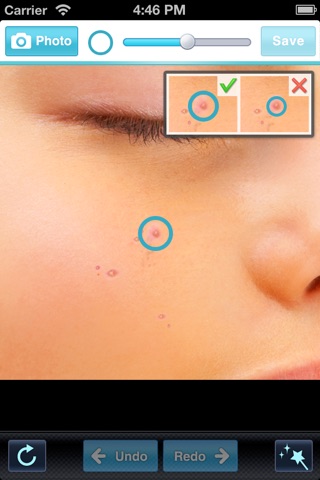 Blemish editor Pimple Remover screenshot 2