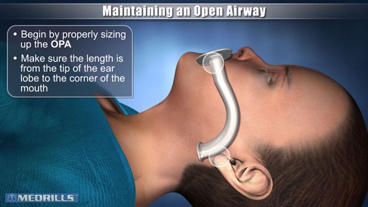 Medrills: Pediatric Airway