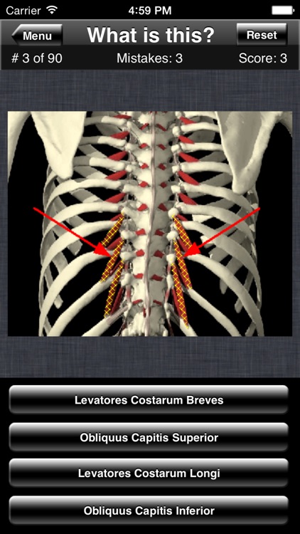 Anatomy Spine Quiz screenshot-3