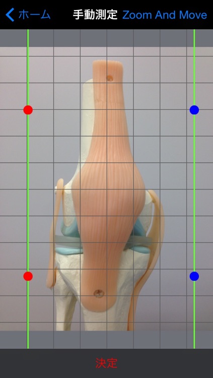 Measurement of ROM Angle - use 4 markers for Clinical Research