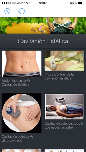 Cavitacion Estetica(圖1)-速報App