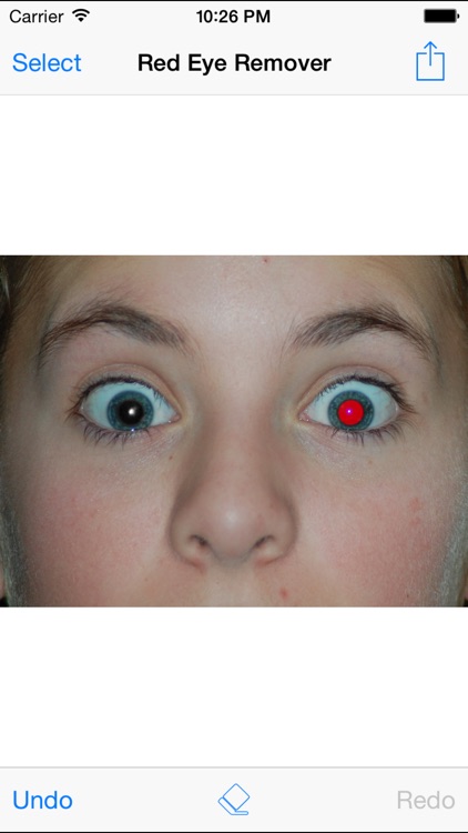 Red Eye Remover