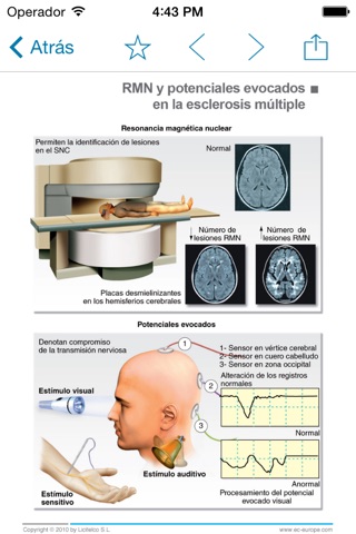 Miniatlas Multiple Sclerosis screenshot 3