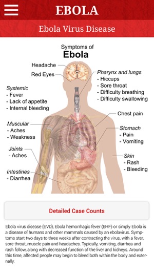 Ebola Virus - (Tracker and Information)(圖4)-速報App