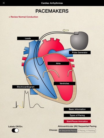 HeartCharts screenshot 4