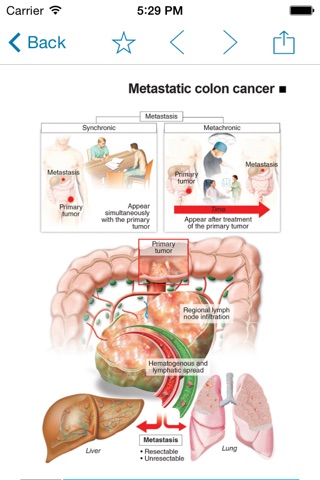 Miniatlas Colon Cancer screenshot 4