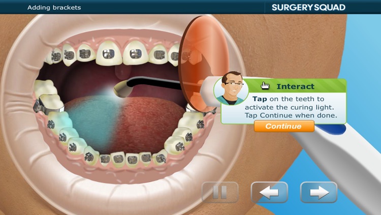 Virtual Braces