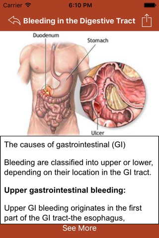 Stomach Conditions & Treatment screenshot 3