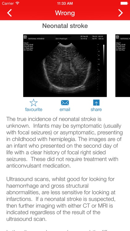 Cranial Ultrasound screenshot-3