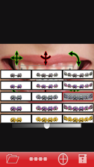 Orthodontic تقويم الاسنان(圖3)-速報App