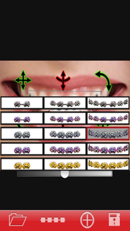 Orthodontic تقويم الاسنان