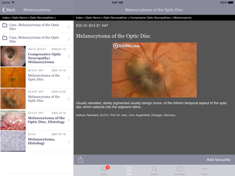 Atlas of Ophthalmology HD by Onjoph screenshot 2