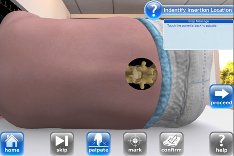 Infant Lumbar Puncture Champagne Tap screenshot 2