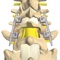 mLumbarPosteriorInterbodyFusionCage is an information resource for the surgical procedure known as a posterior lumbar interbody fusion with cage, or PLIF