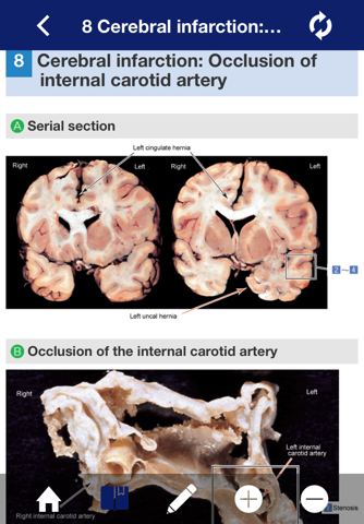 ATLAS OF PATHOLOGY And Comparison With Normal Anatomy screenshot 2