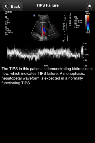 Doppler US screenshot 3