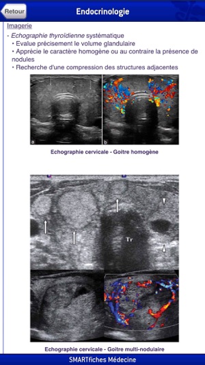 SMARTfiches Endocrinologie(圖4)-速報App