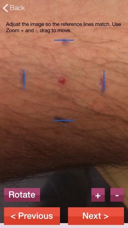 MoleWatcher screenshot-4
