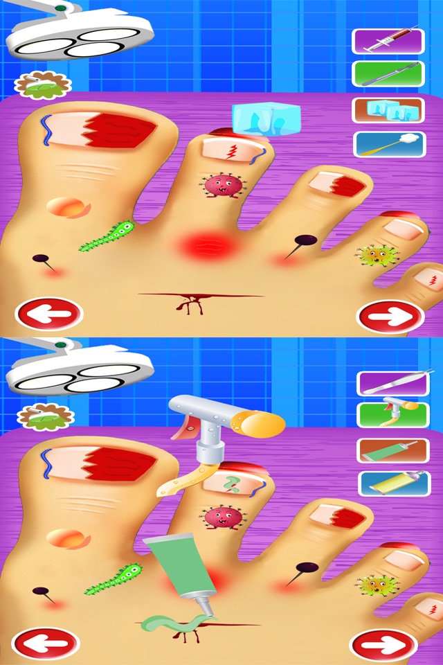 Crazy Little Monster Toe Nails Virtual Surgery Doctor - Free Fun Kids Hospital Game screenshot 4
