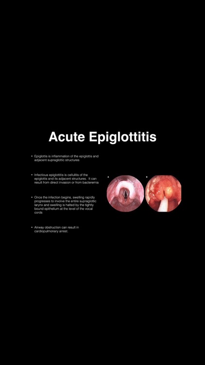 Pulmonary Blueprint PANCE PANRE Review Course