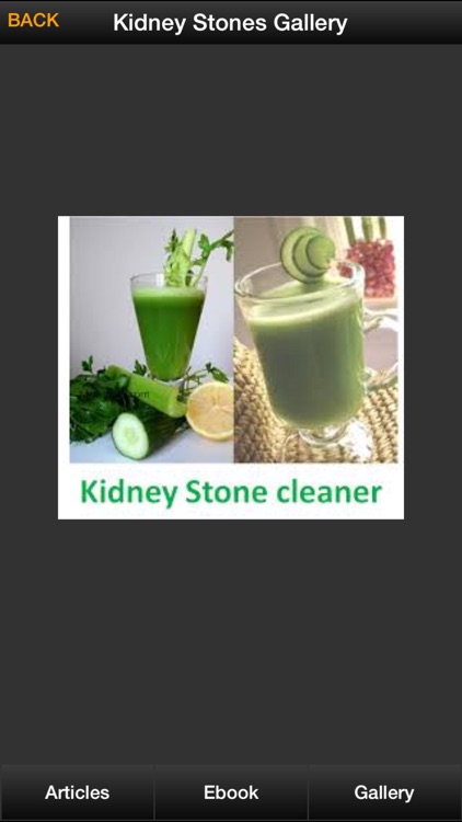 Kidney Stones Guide - How To Prevent & Treat Kidney Stones Symptoms screenshot-3