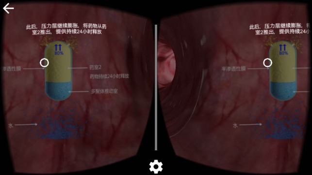 VR视频(医文立德)(圖2)-速報App