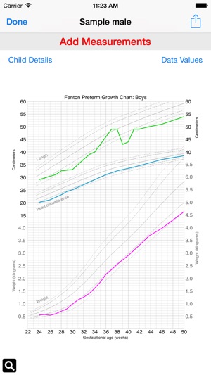 Preterm Growth Tracker(圖1)-速報App