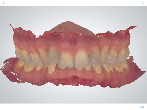 3Shape TRIOS® for orthodontic clinics screenshot 4