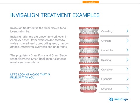 Invisalign Pro Consultation screenshot 2