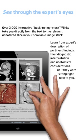 Radiology - Fundamentals of Thoracic Imaging(圖4)-速報App