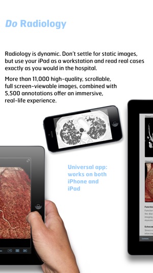 Radiology - Fundamentals of Thoracic Imaging(圖3)-速報App