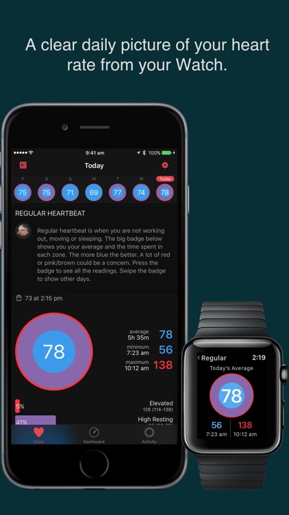 HeartWatch. Heart & Activity Monitor for Watch