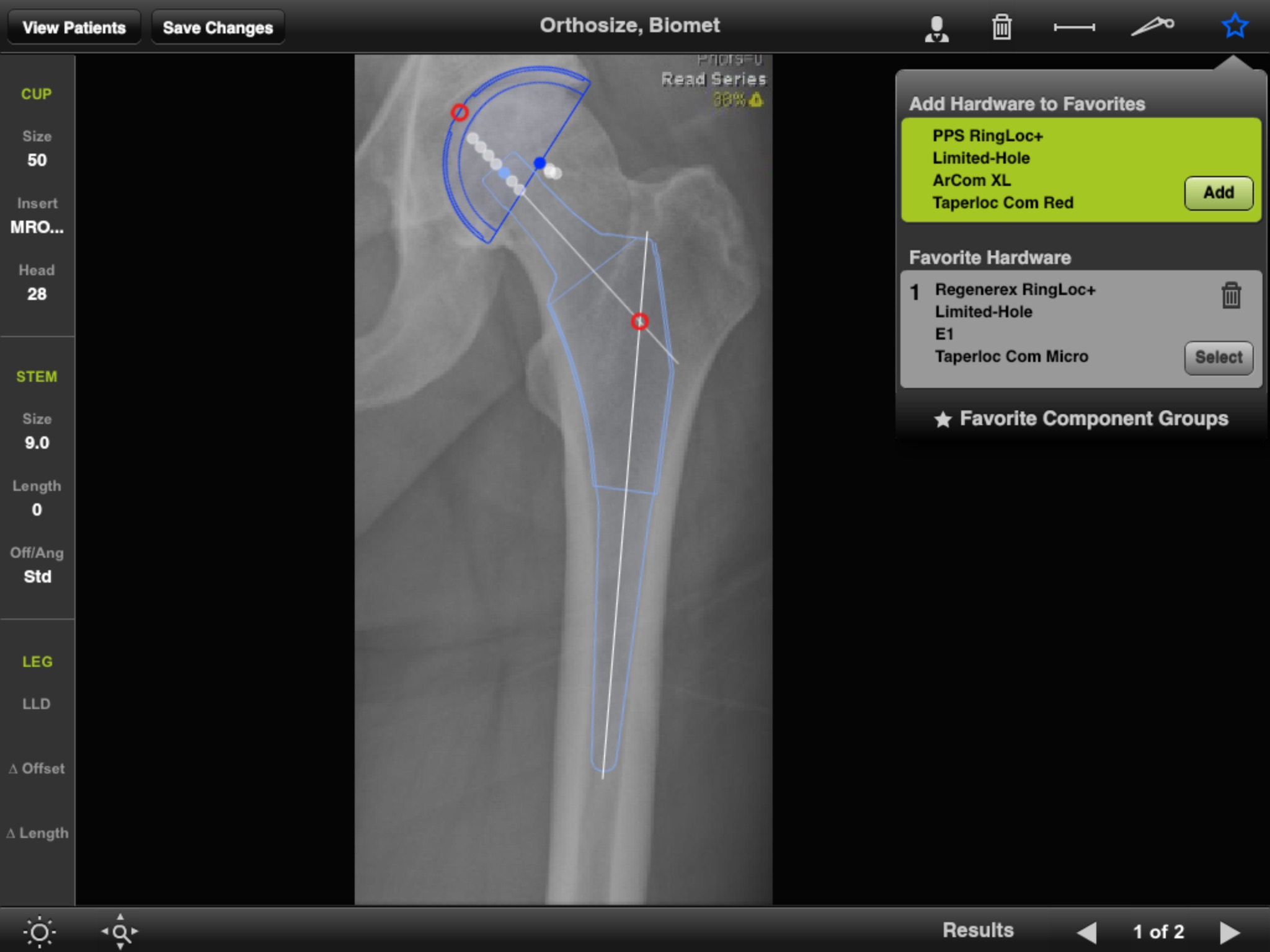 Biomet Orthosize Templating screenshot 4