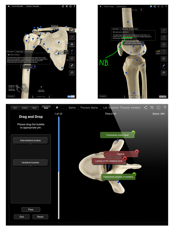 Skeleton System Pro III Screenshot 2