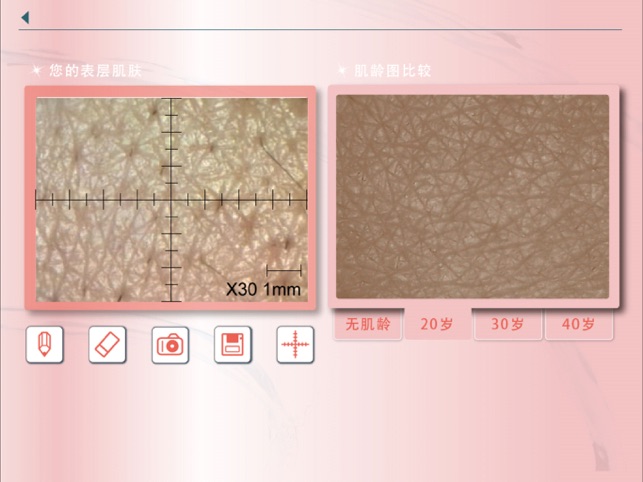 Skin Analyser(圖2)-速報App