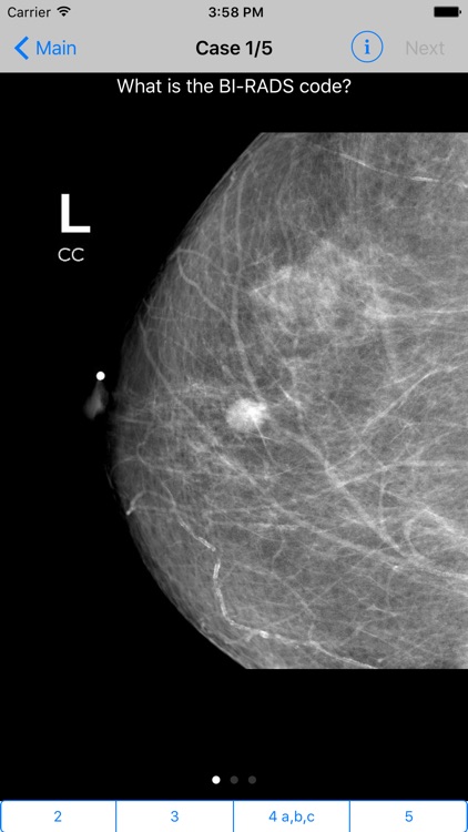 Mammogram Atlas screenshot-4