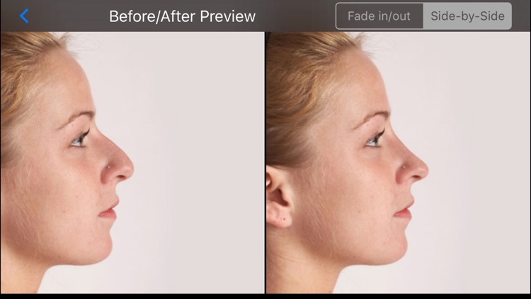 FaceTouchUp Nose Job & Rhinoplasty Simulator