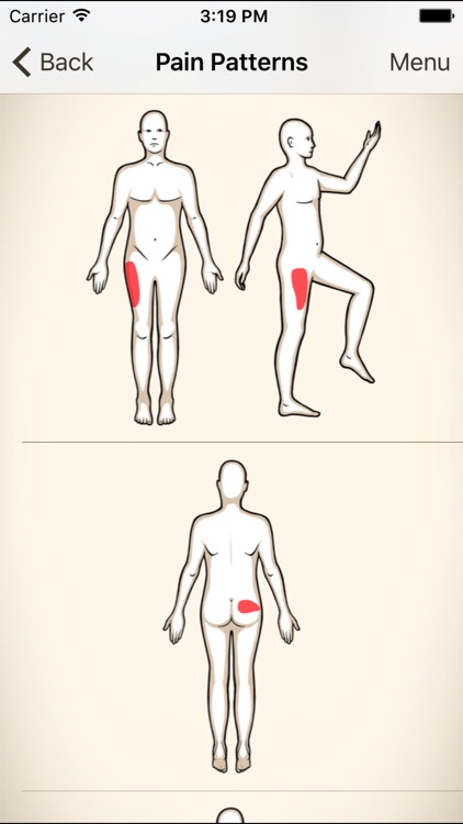 Clinical Pattern Recognition: Hip and Thigh Pain