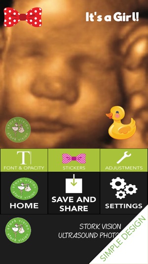 Stork Vision Ultrasound Photo Booth(圖2)-速報App