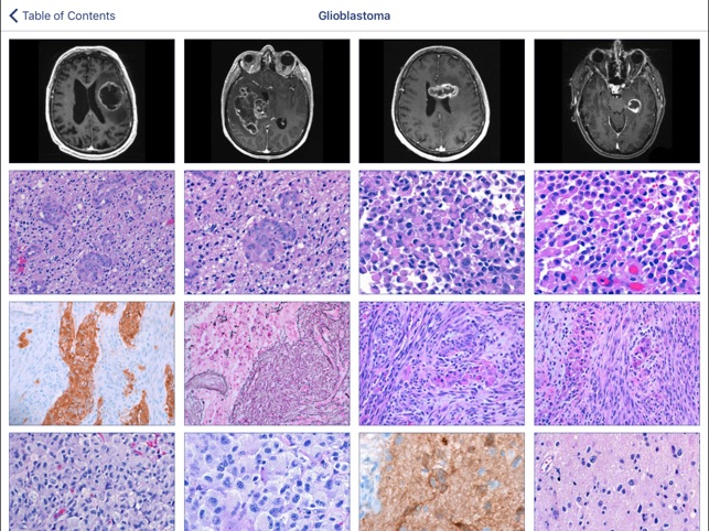 Johns Hopkins Atlas of Surgical Neuropathology(圖2)-速報App