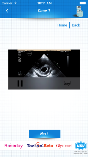 ECHO and ECG Interpretation(圖5)-速報App