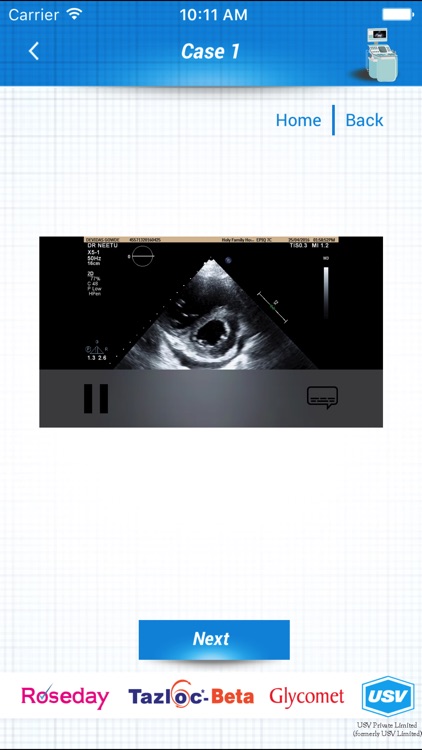 ECHO and ECG Interpretation screenshot-4