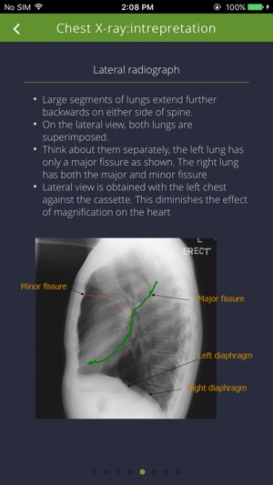 Chest Radiographs(圖4)-速報App