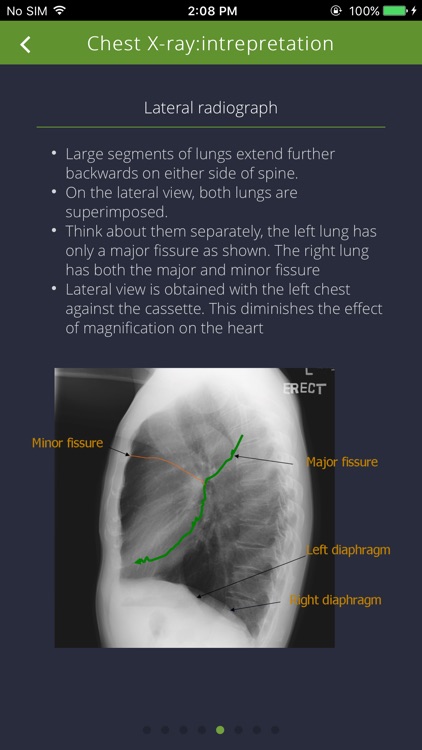 Chest Radiographs screenshot-3