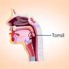 Tonsillitis 101-Rational Treatment Guide and Tips