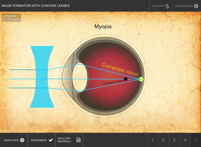 Img Formation w Concave Lenses(圖1)-速報App